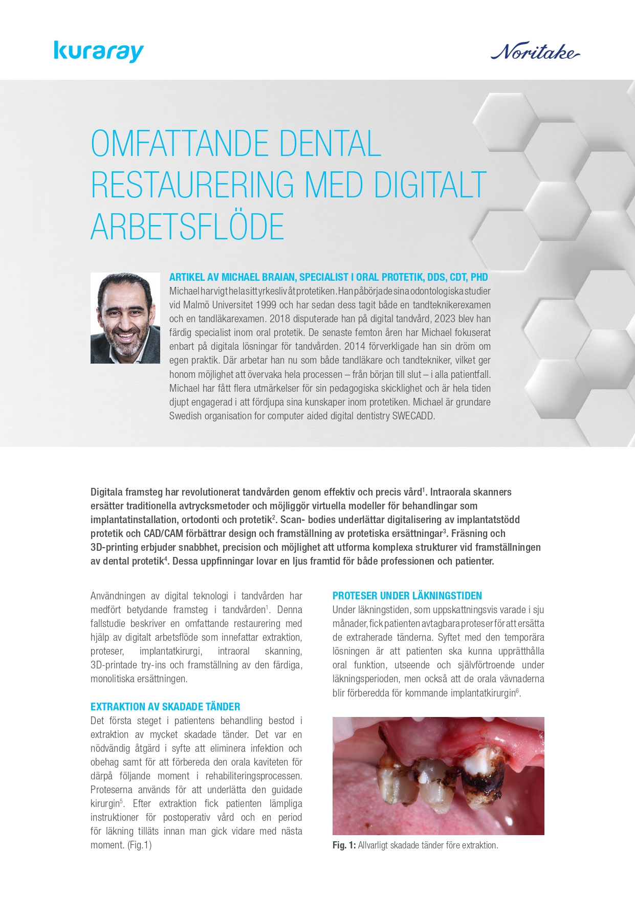 2322960 Article Comprehensive Dental Rehabilitation SE 03_page-0001